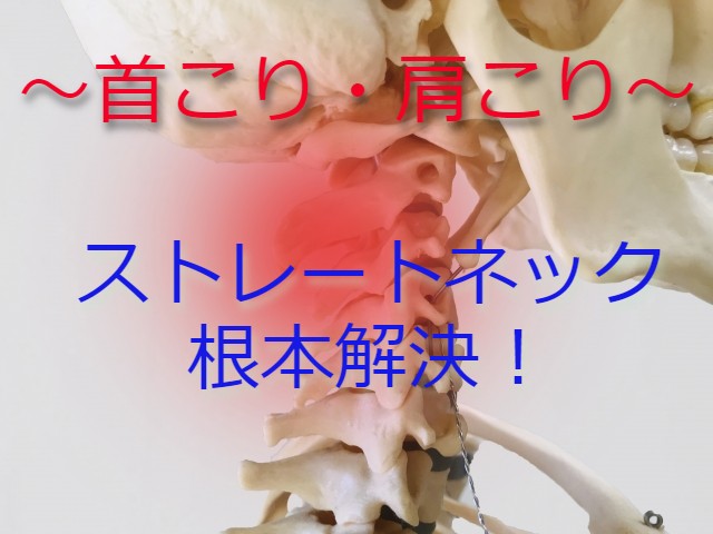 首肩こりとストレートネック矯正