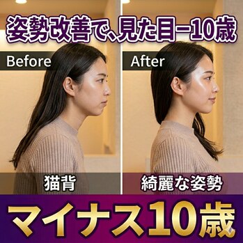 ストレートネック